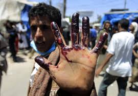 افزایش شهدای حمله سعودی ها به زندان الزیدیه یمن